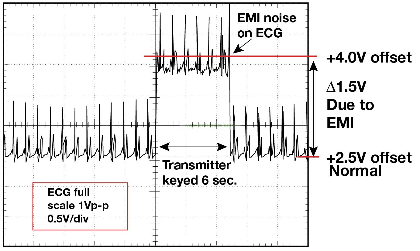 圖 1 1.5 英尺以外的發射器(f = 470 MHz, P= 0.5W)開啟和關閉時 ECG 診斷設備的心臟檢查結果