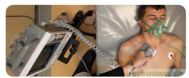 帶電極的醫院用除顫器。注意,患者身上有外部心電圖或心臟監護儀,從胸部的白色圓片(電極)和導聯(線)可看出來。