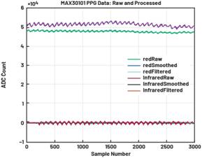 動(dòng)態(tài)離散周期變換技術(shù)突破：無ECG參考的生理信號精準(zhǔn)解析